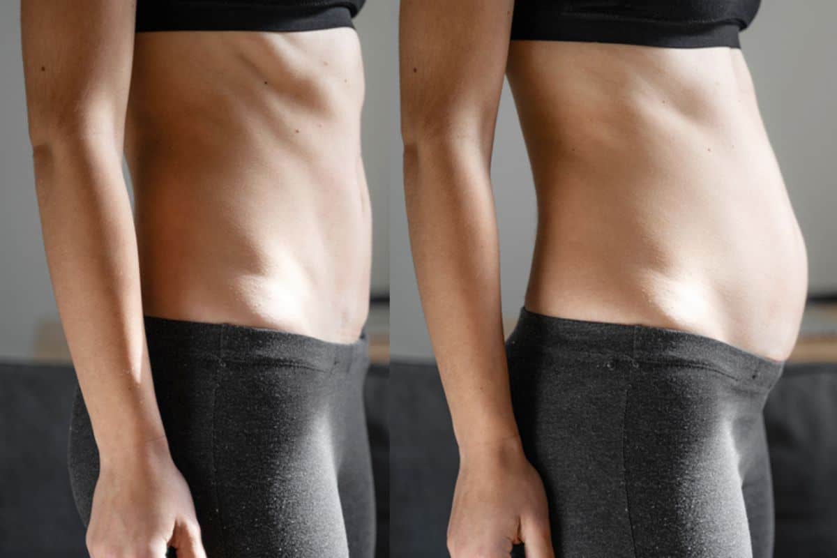 How long does diastasis recti take to improve Buxton?