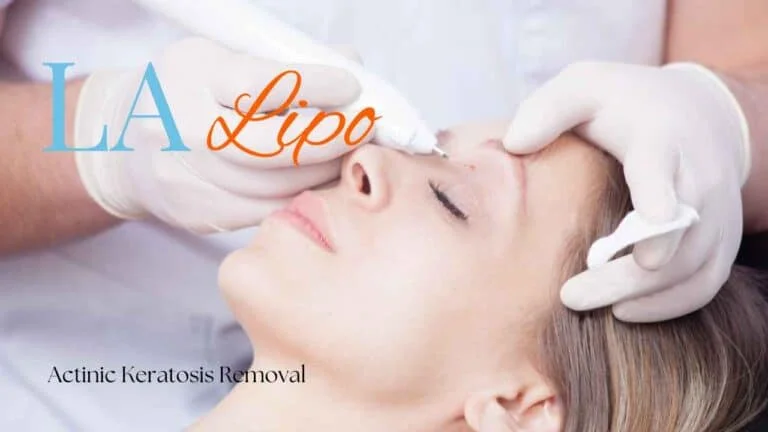 Woman receiving Actinic Keratosis Removal Treatment Buxton