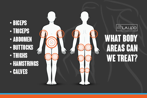 Graphic to show areas you can have LA-EMS Body Sculpting Buxton treatment.